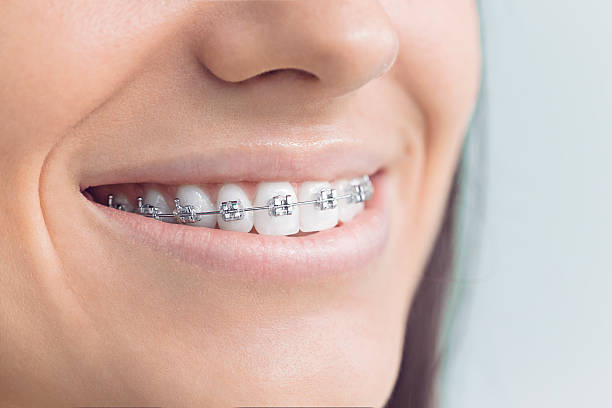 Full Mouth Reconstruction in Brock Hall, MD